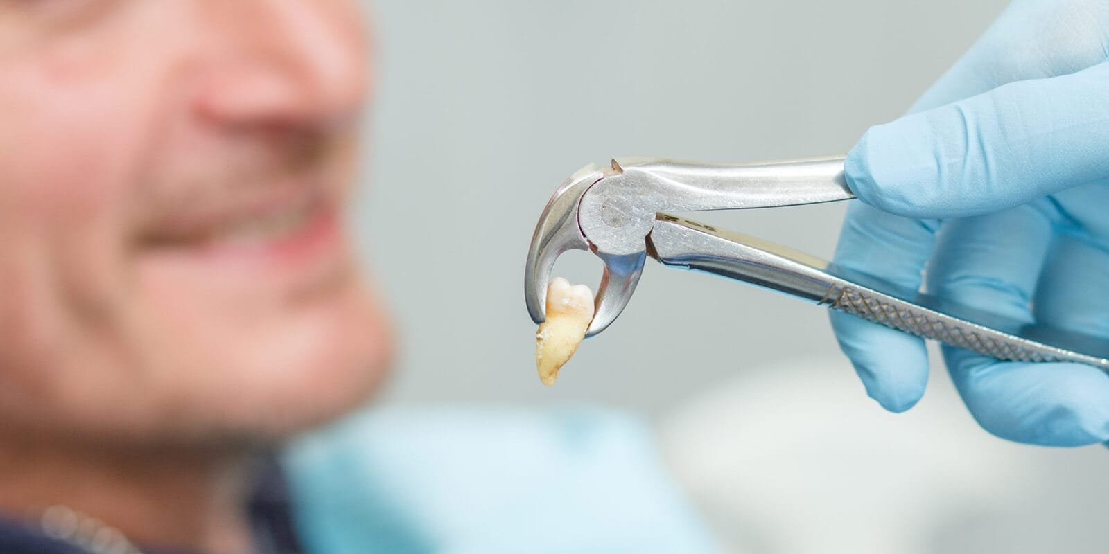 Impacted tooth extraction - Serdent Eskisehir