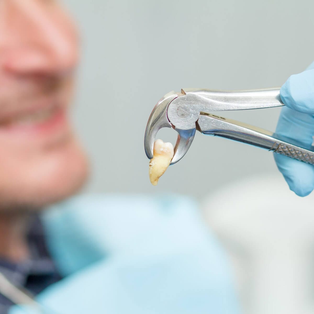 Impacted wisdom tooth extraction - Serdent dental clinic in Eskisehir