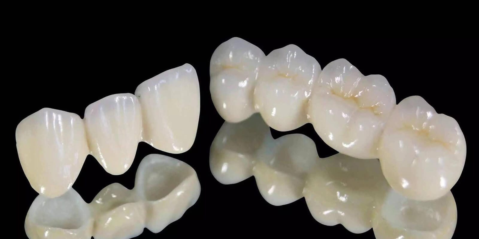 Laminate veneers and zirconia crowns