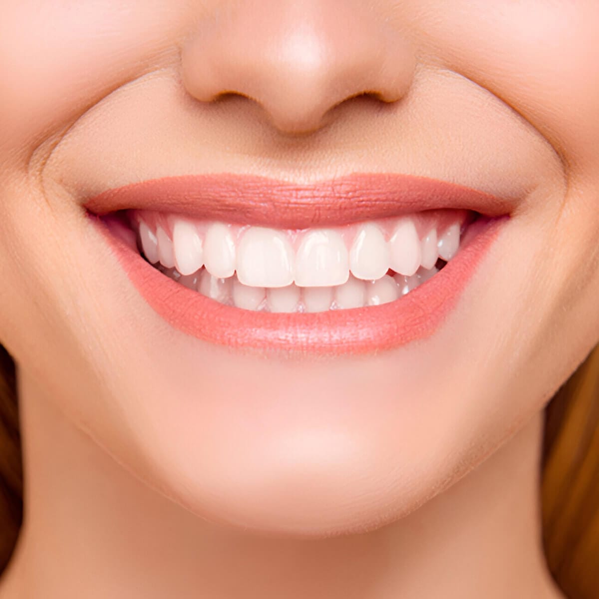 Smile design treatment - Serdent dental clinic in Eskisehir
